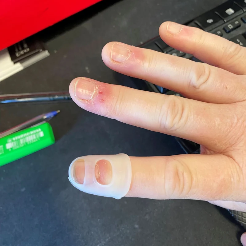 Picky Finger Protectors 10 Pack